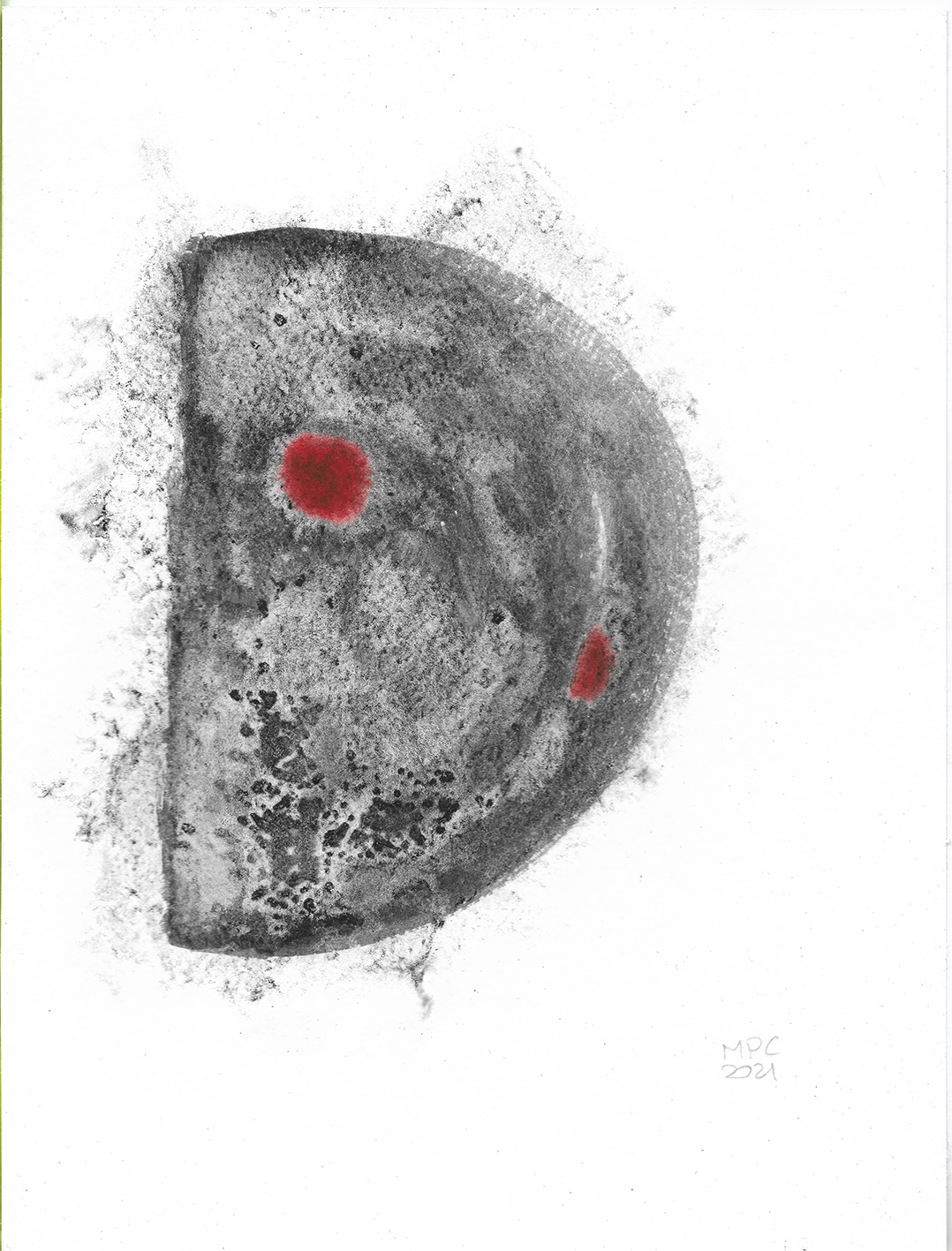 Mamografias12